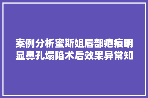 案例分析蜜斯姐唇部疤痕明显鼻孔塌陷术后效果异常知足