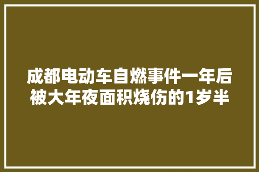 成都电动车自燃事件一年后被大年夜面积烧伤的1岁半女婴仍面临耐久手术
