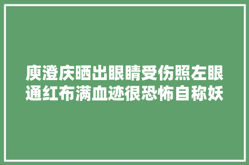 庾澄庆晒出眼睛受伤照左眼通红布满血迹很恐怖自称妖孽作怪